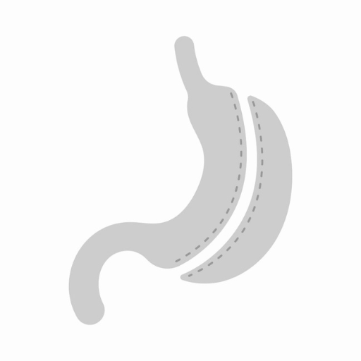 Sleeve Gastrectomy icon 512x512